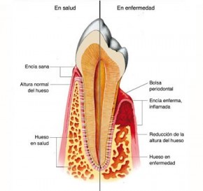 Foto periodoncia