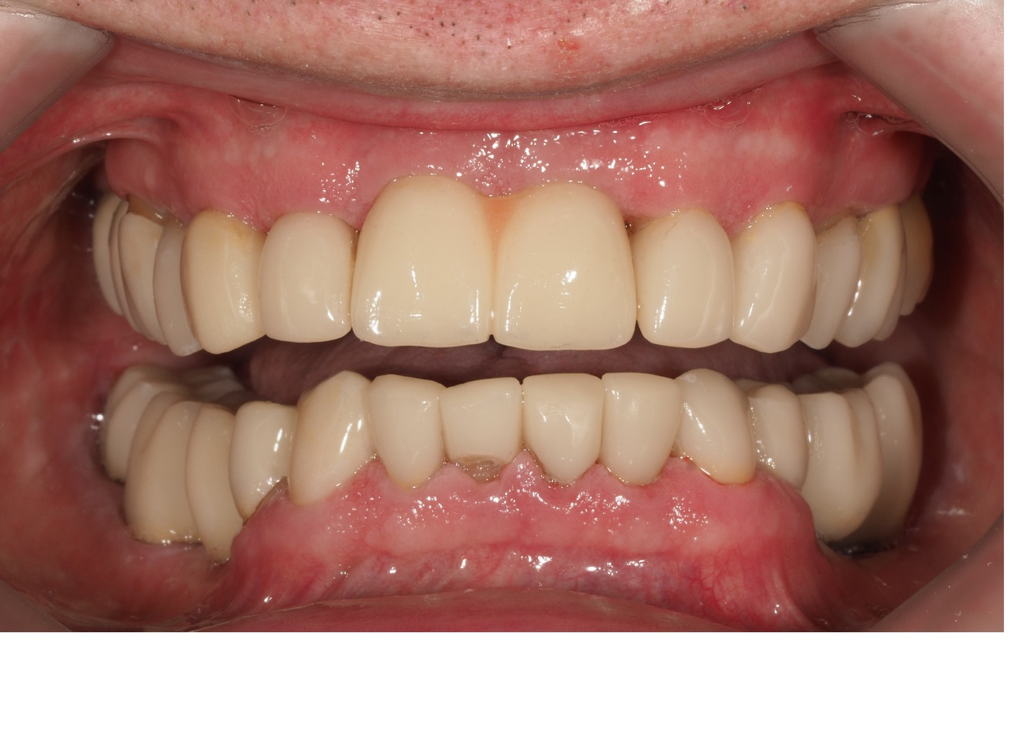 After image