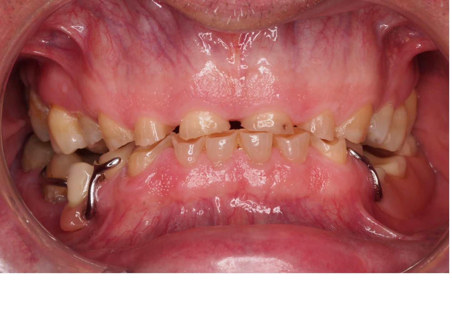 Before image