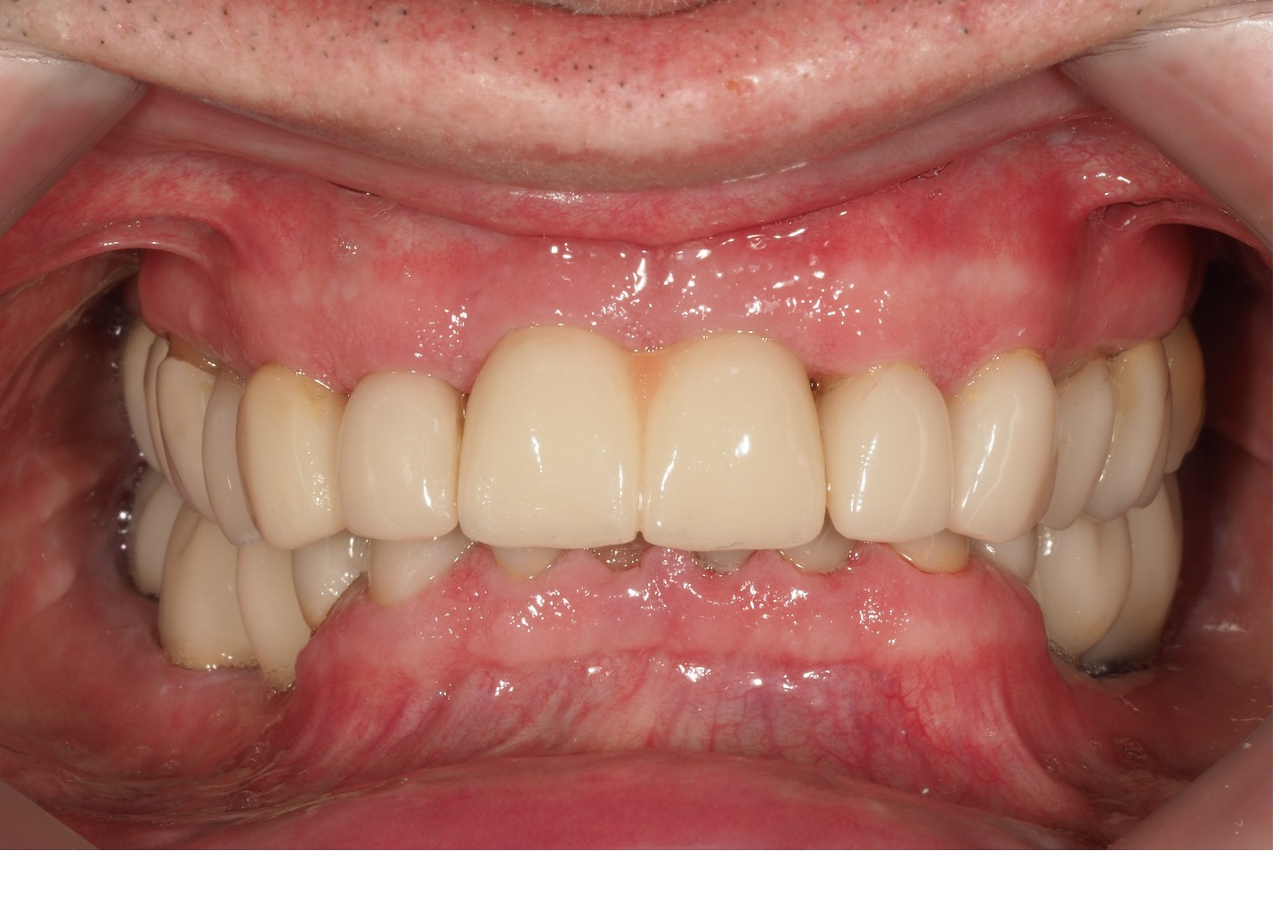 After image