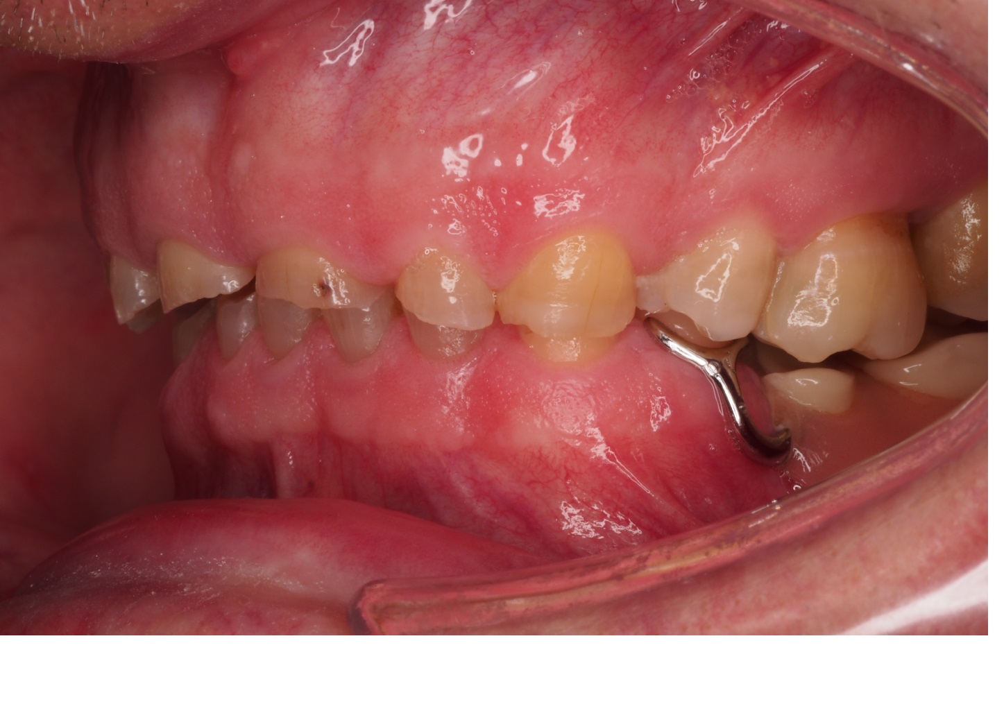 Before image
