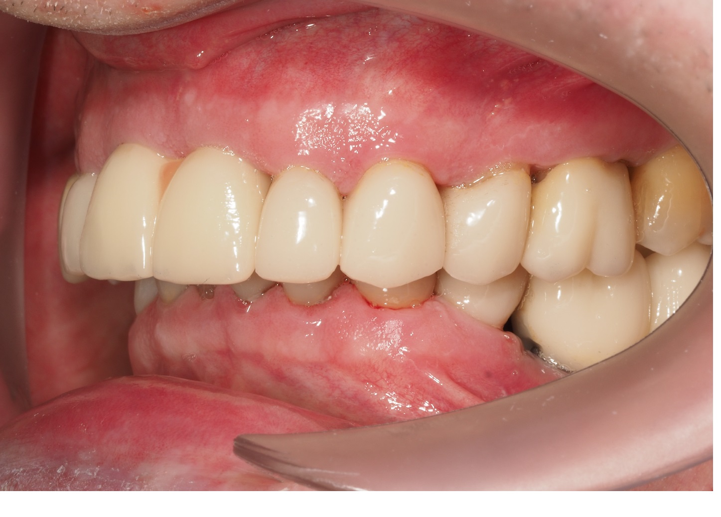 After image