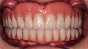 Odontología de alto rendimiento