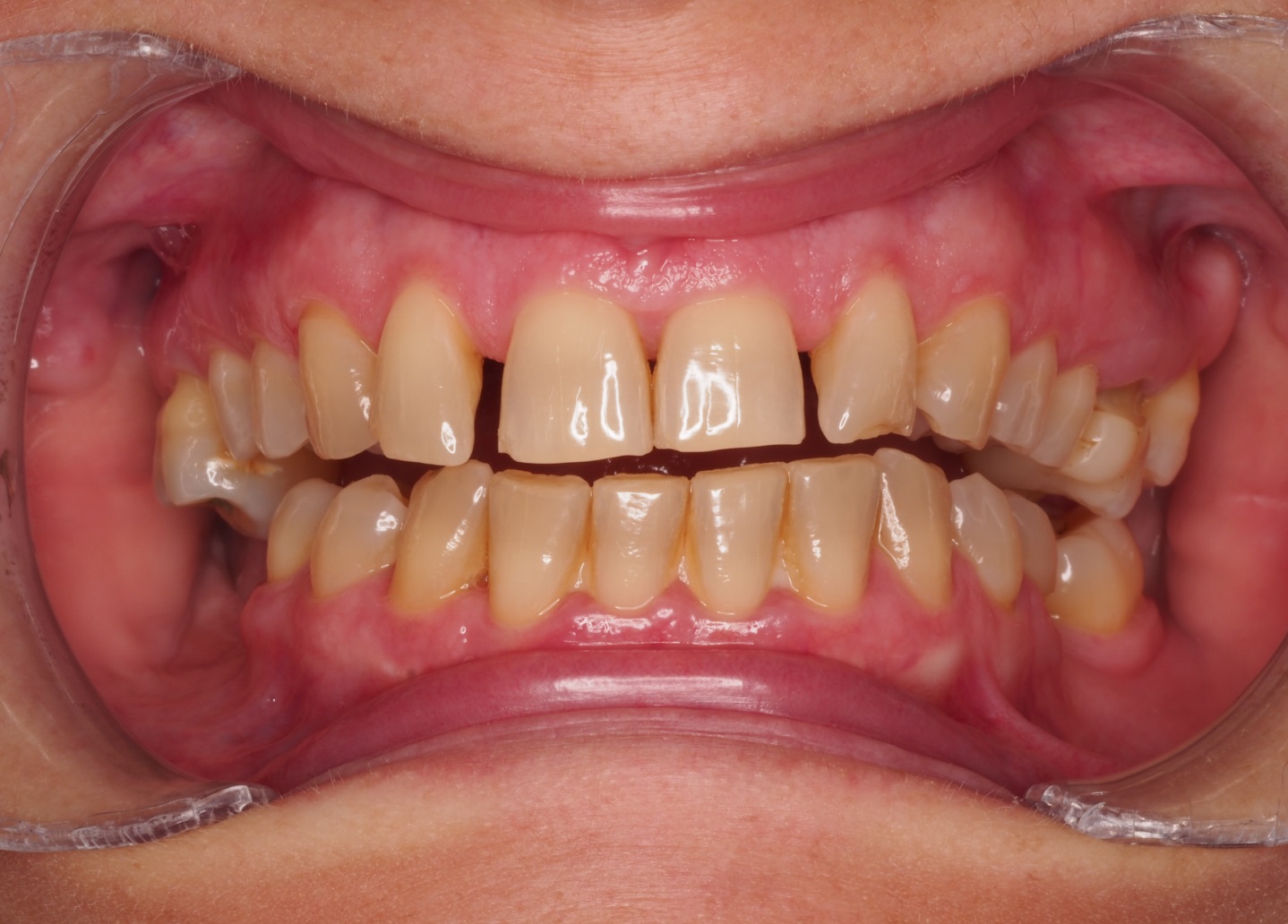Before image
