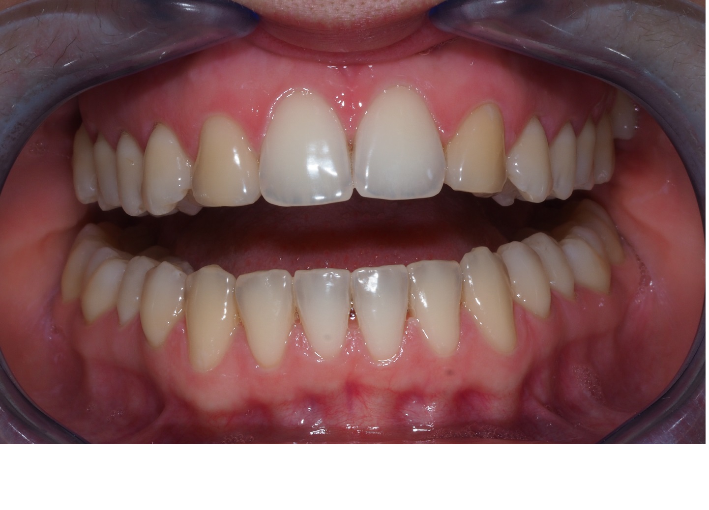 Before image