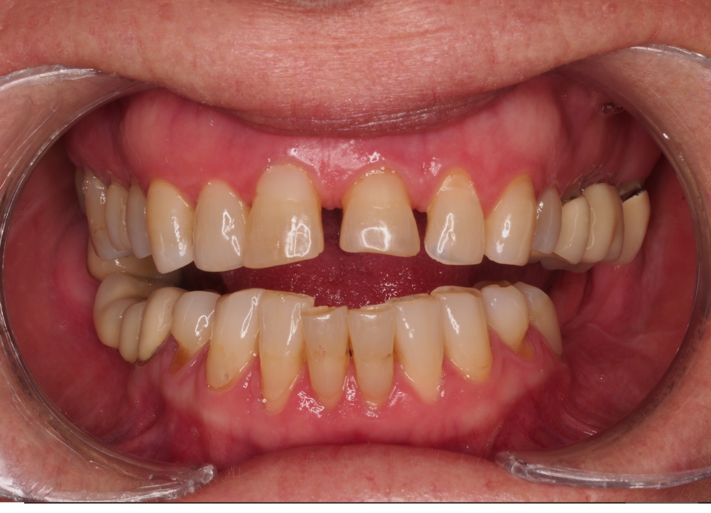 Before image