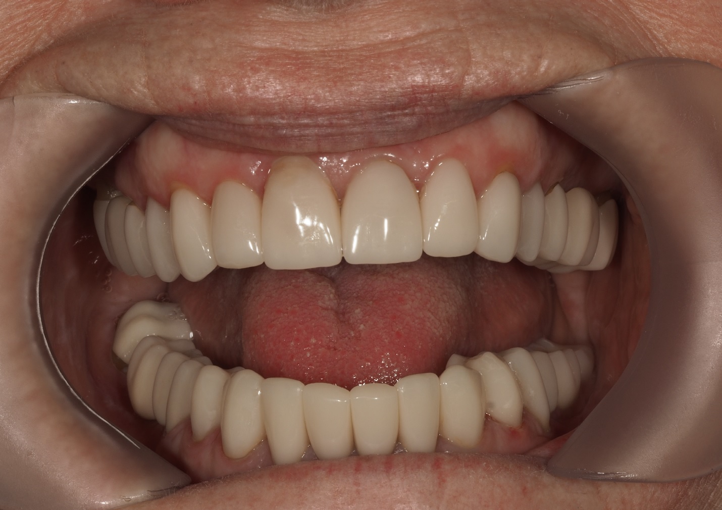 After image