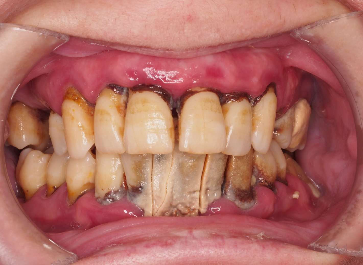 Before image