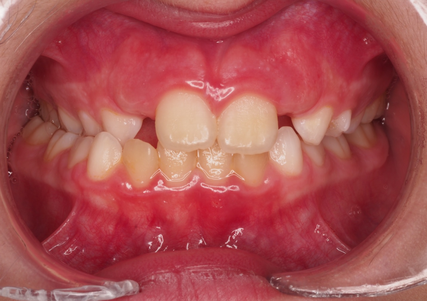 Before image