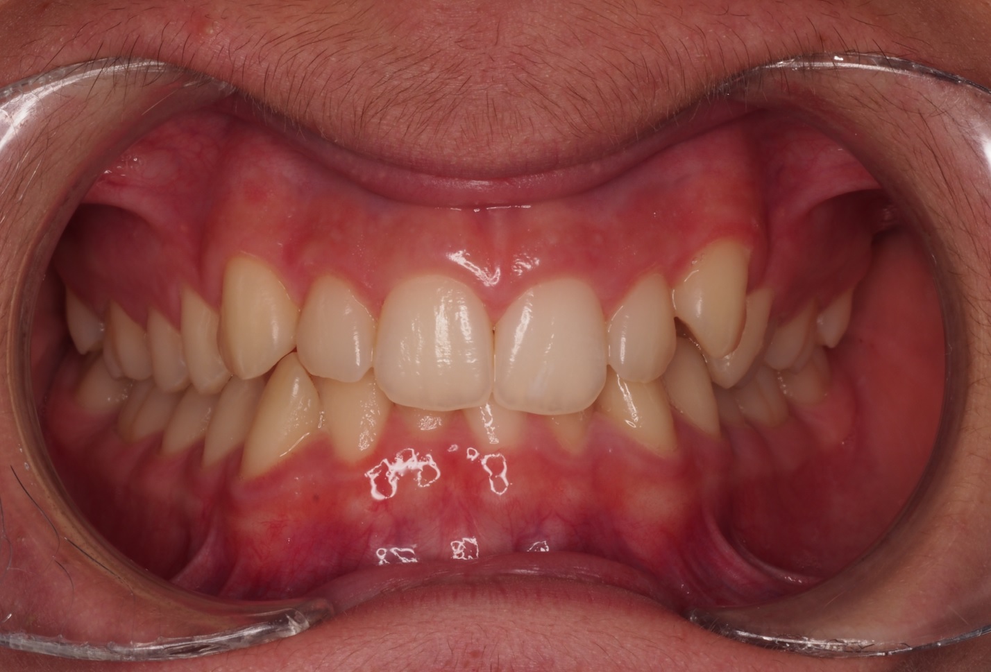 Before image