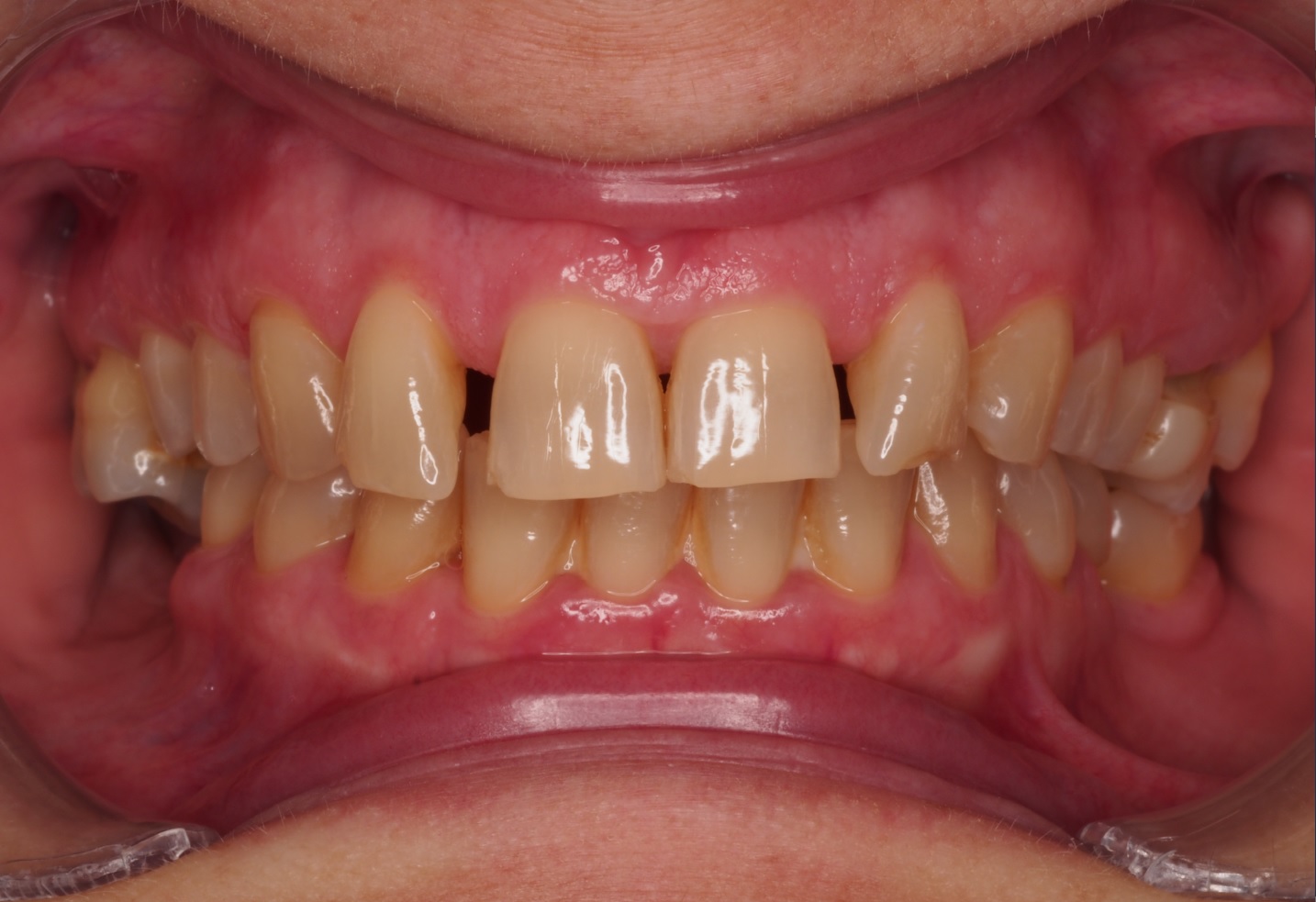 Before image