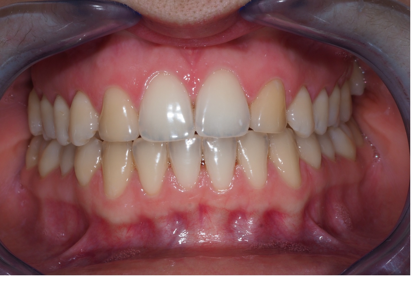 Before image
