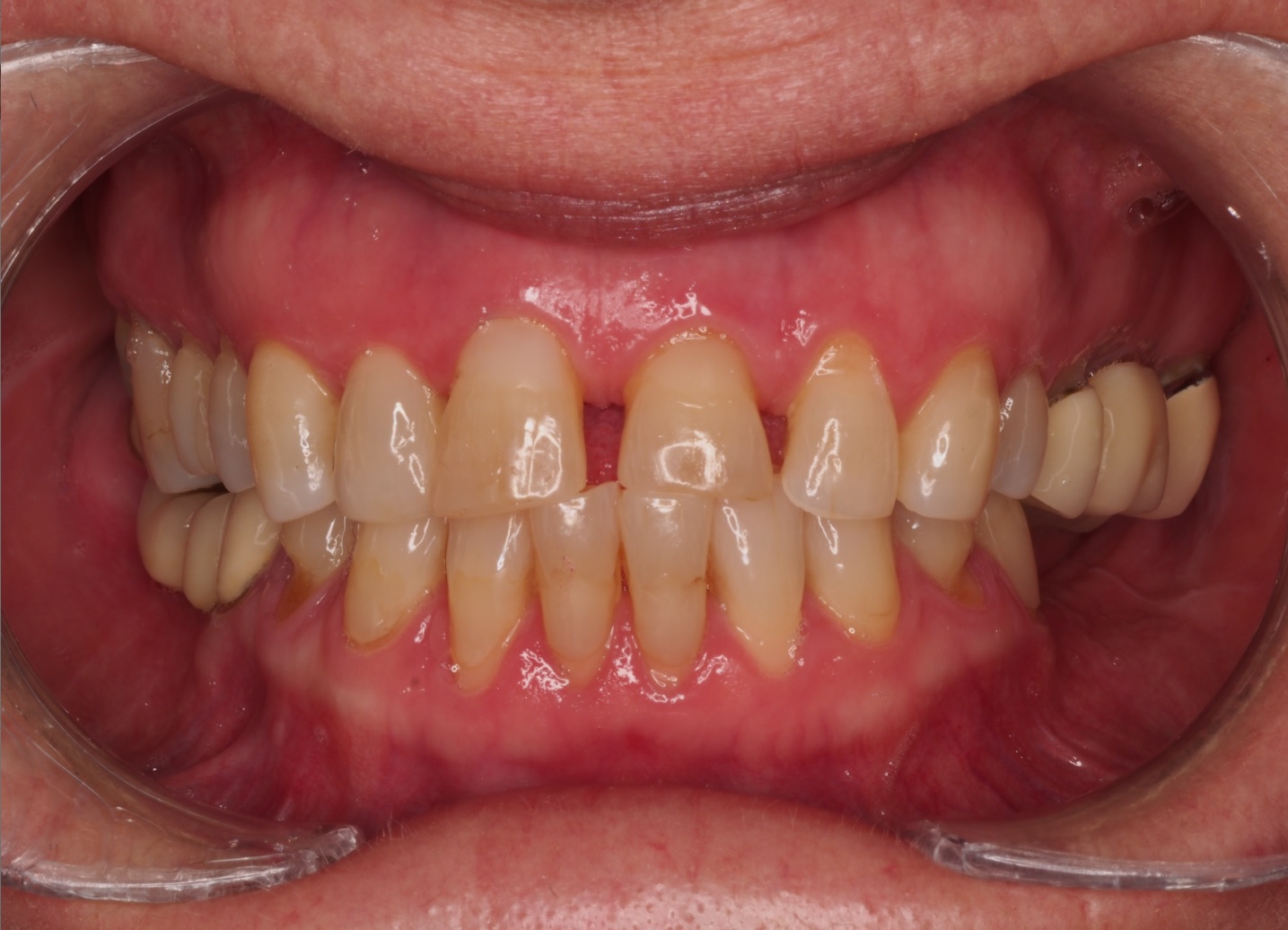 Before image