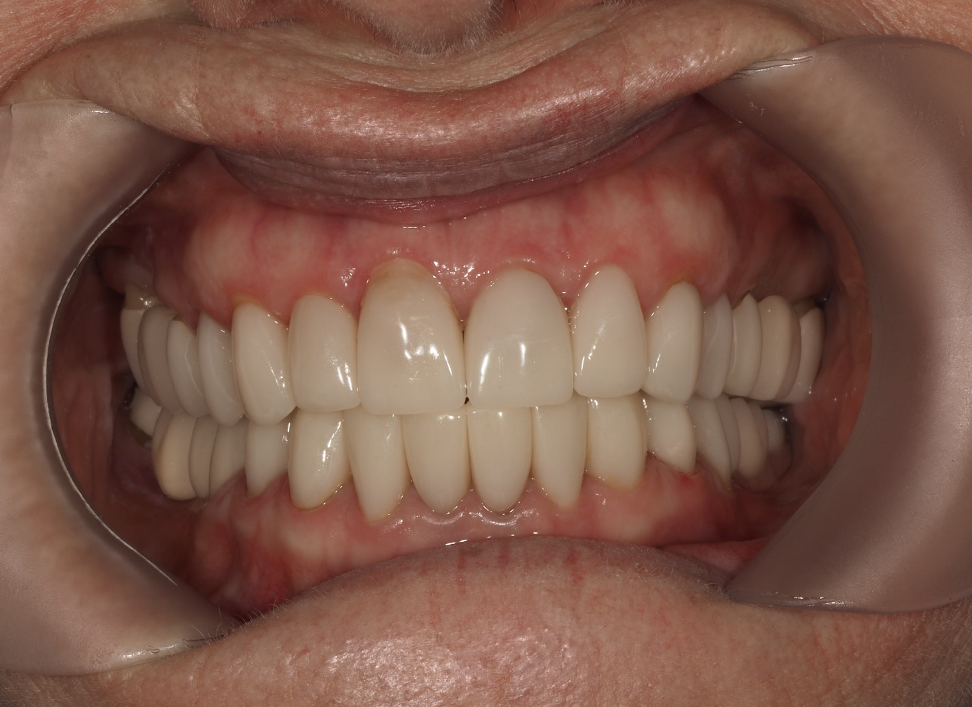 After image
