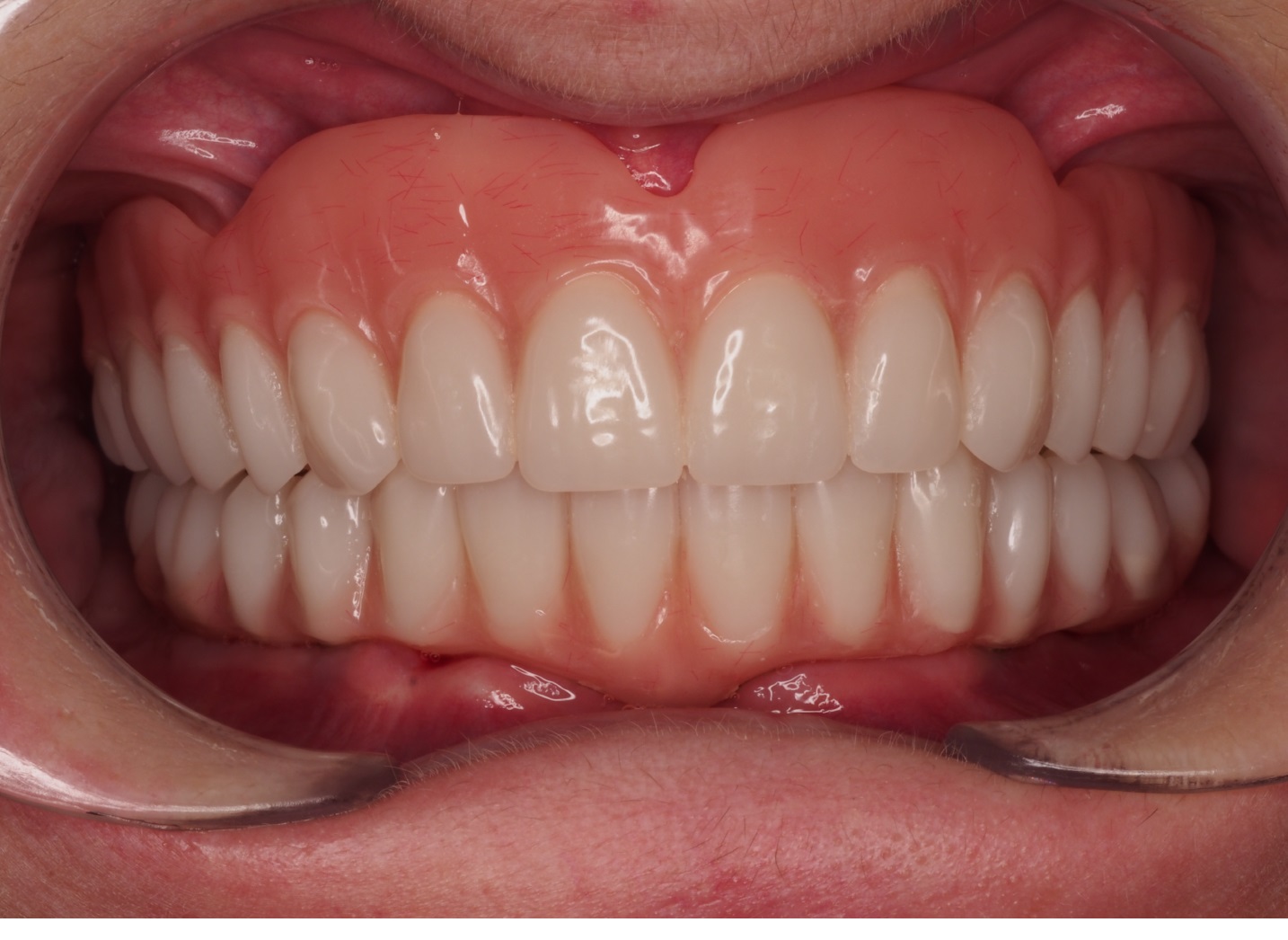 After image