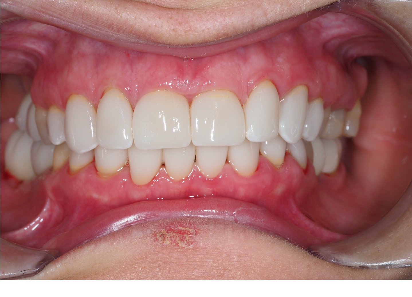 After image