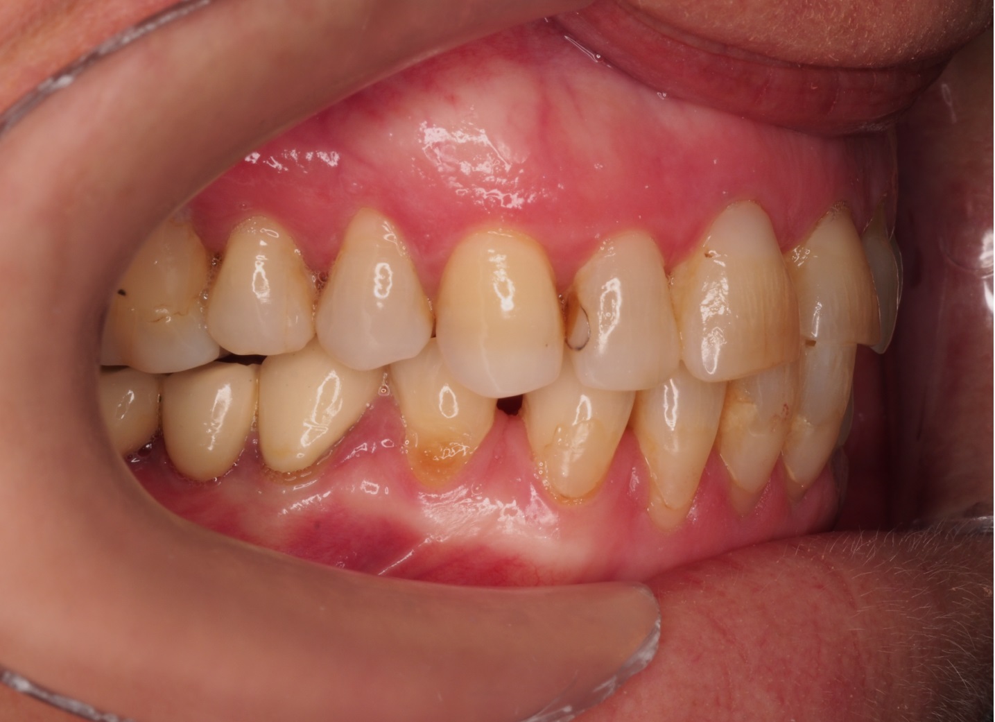 Before image