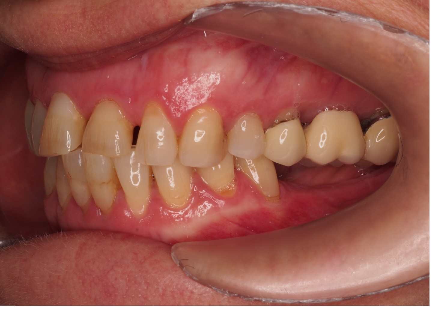 Before image