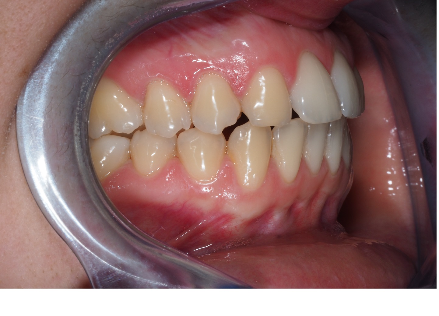 Before image