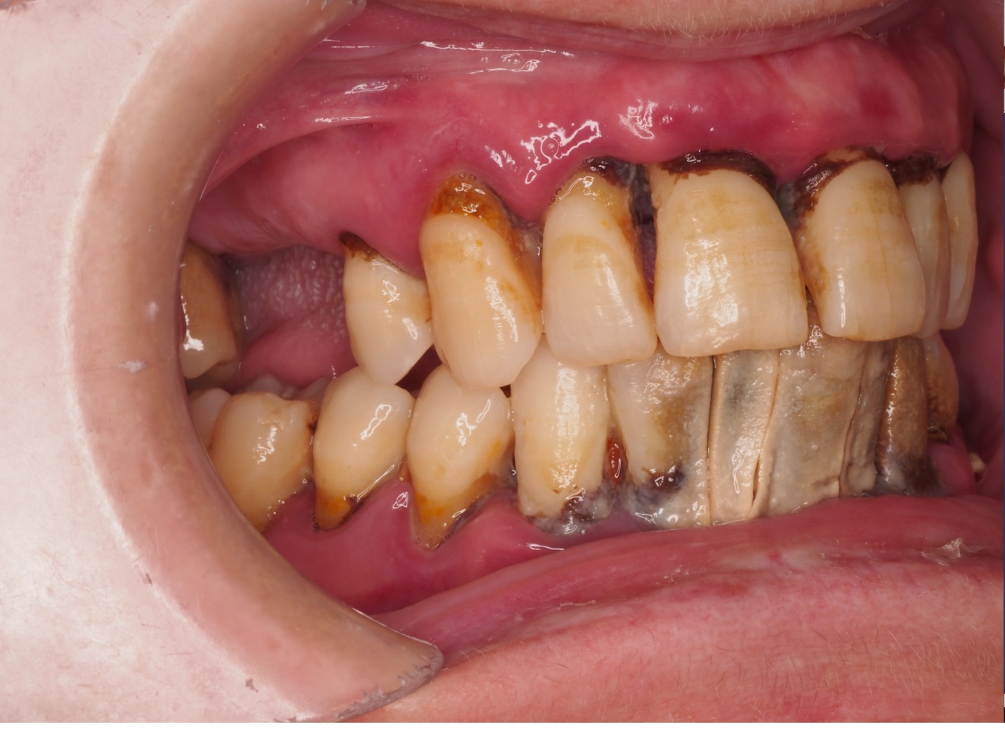 Before image