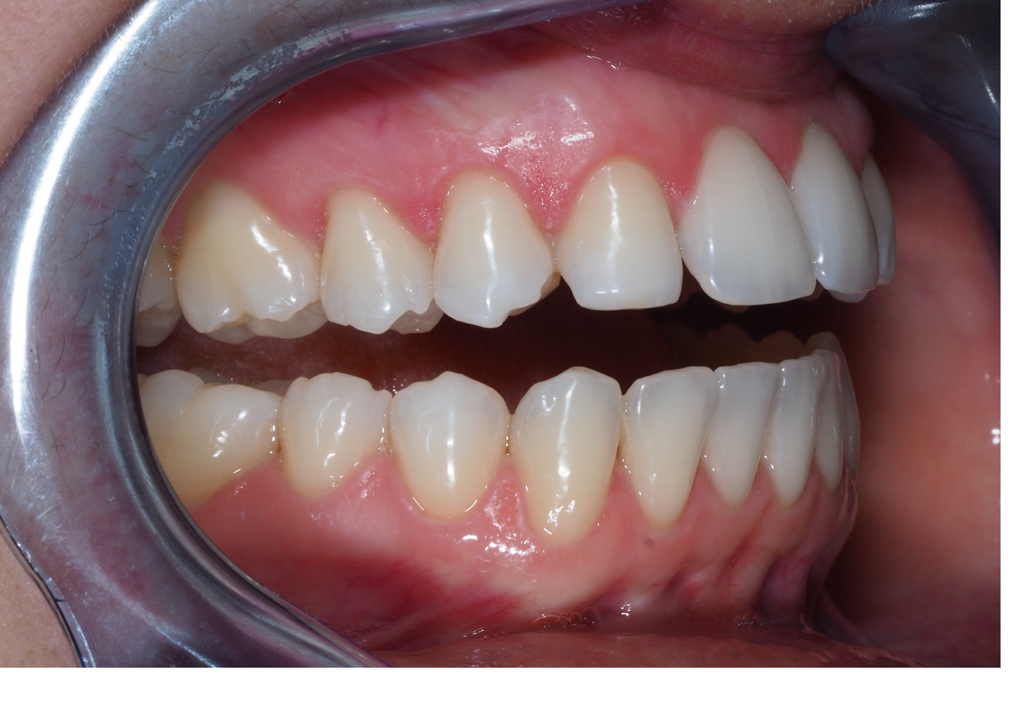 After image