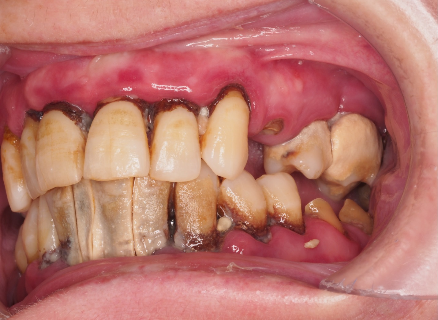 Before image
