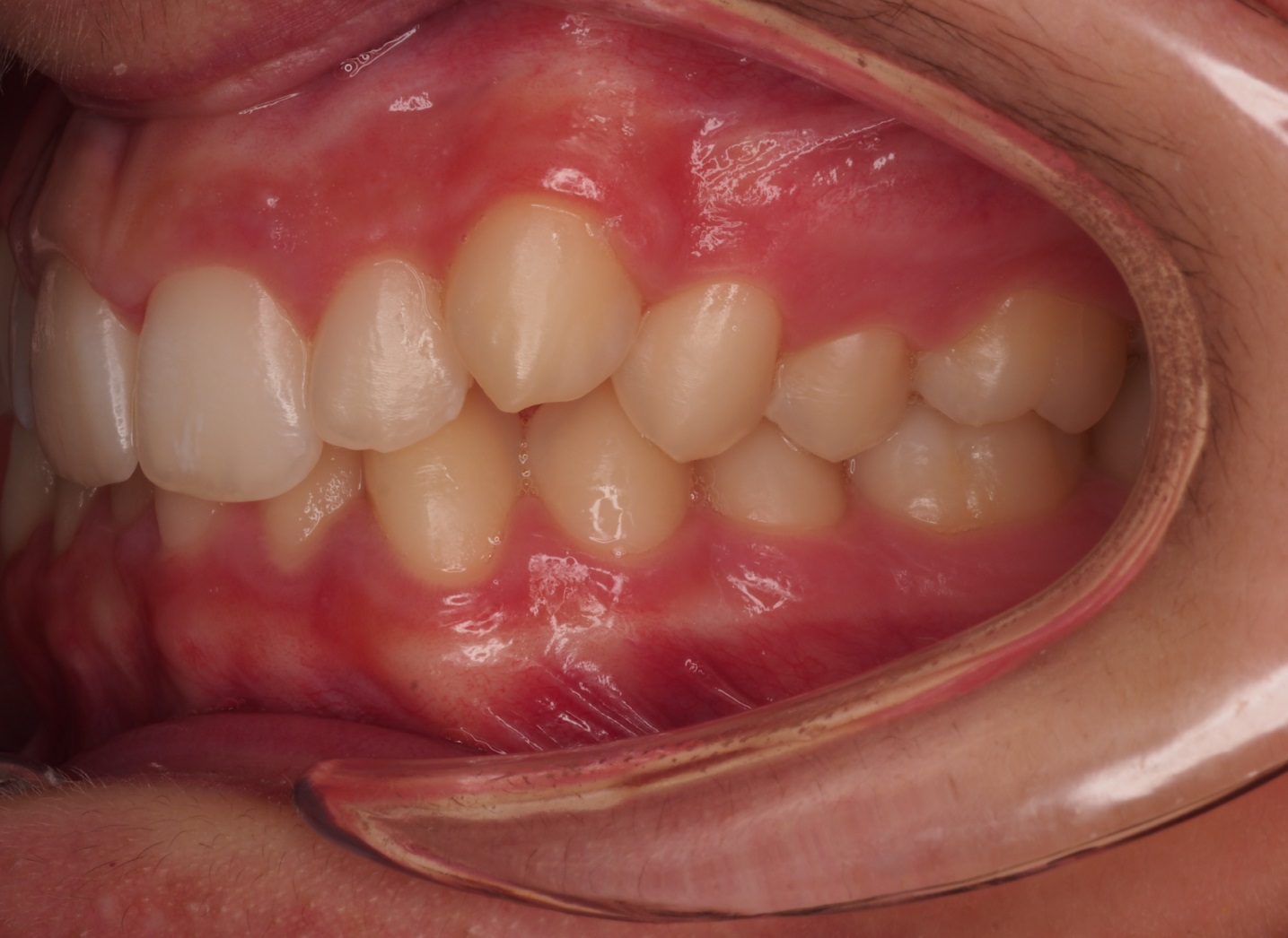Before image