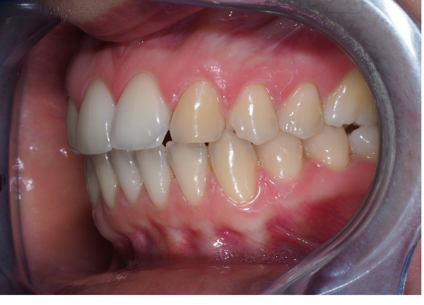 Before image