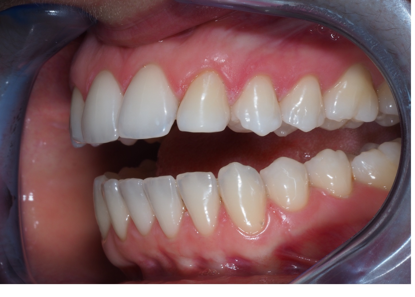 After image