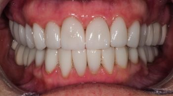 Rehabilitación funcional y estética