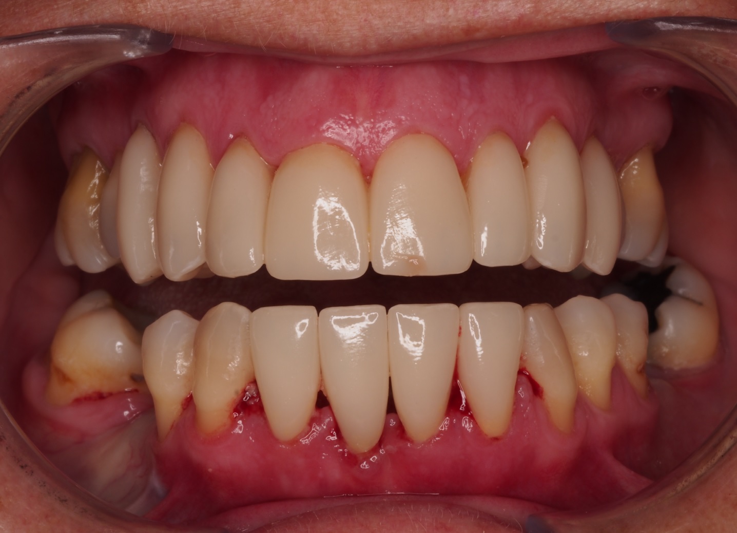 Before image