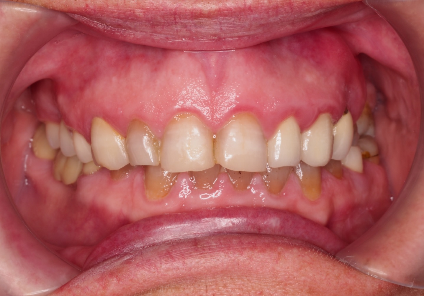 Before image