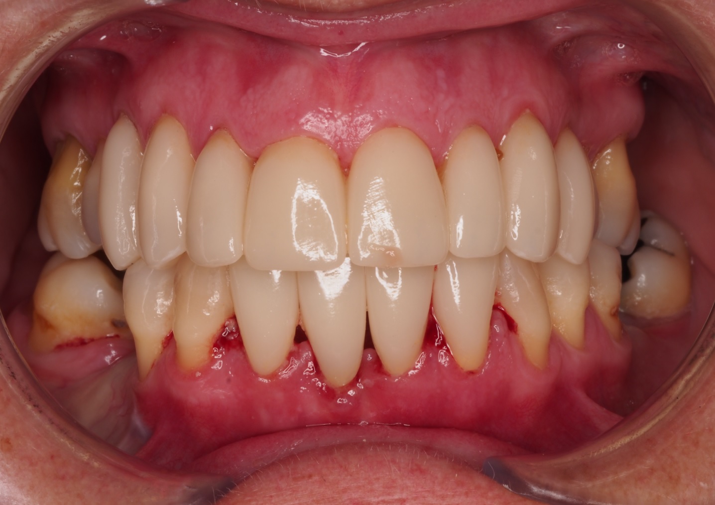 Before image