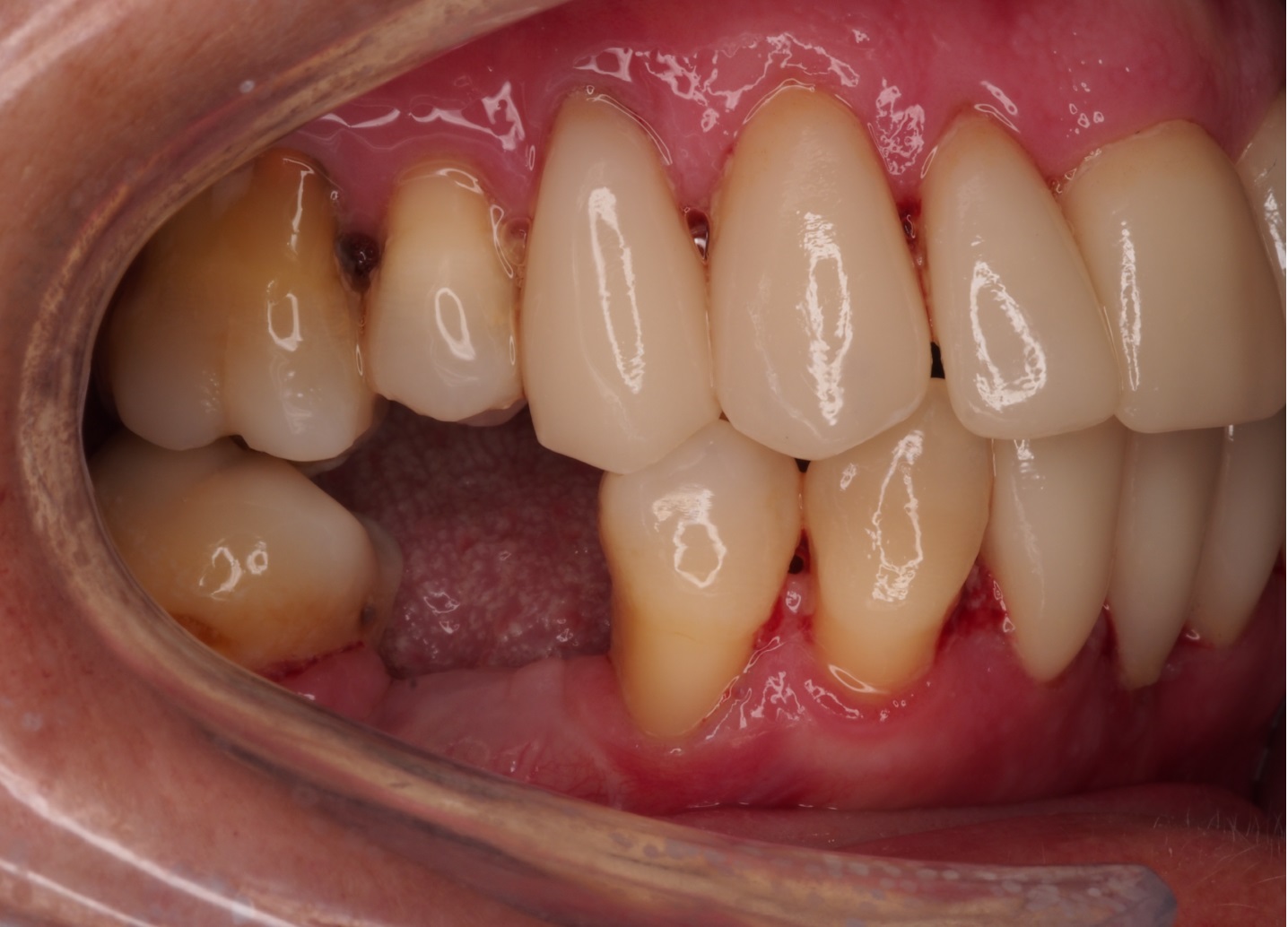 Before image