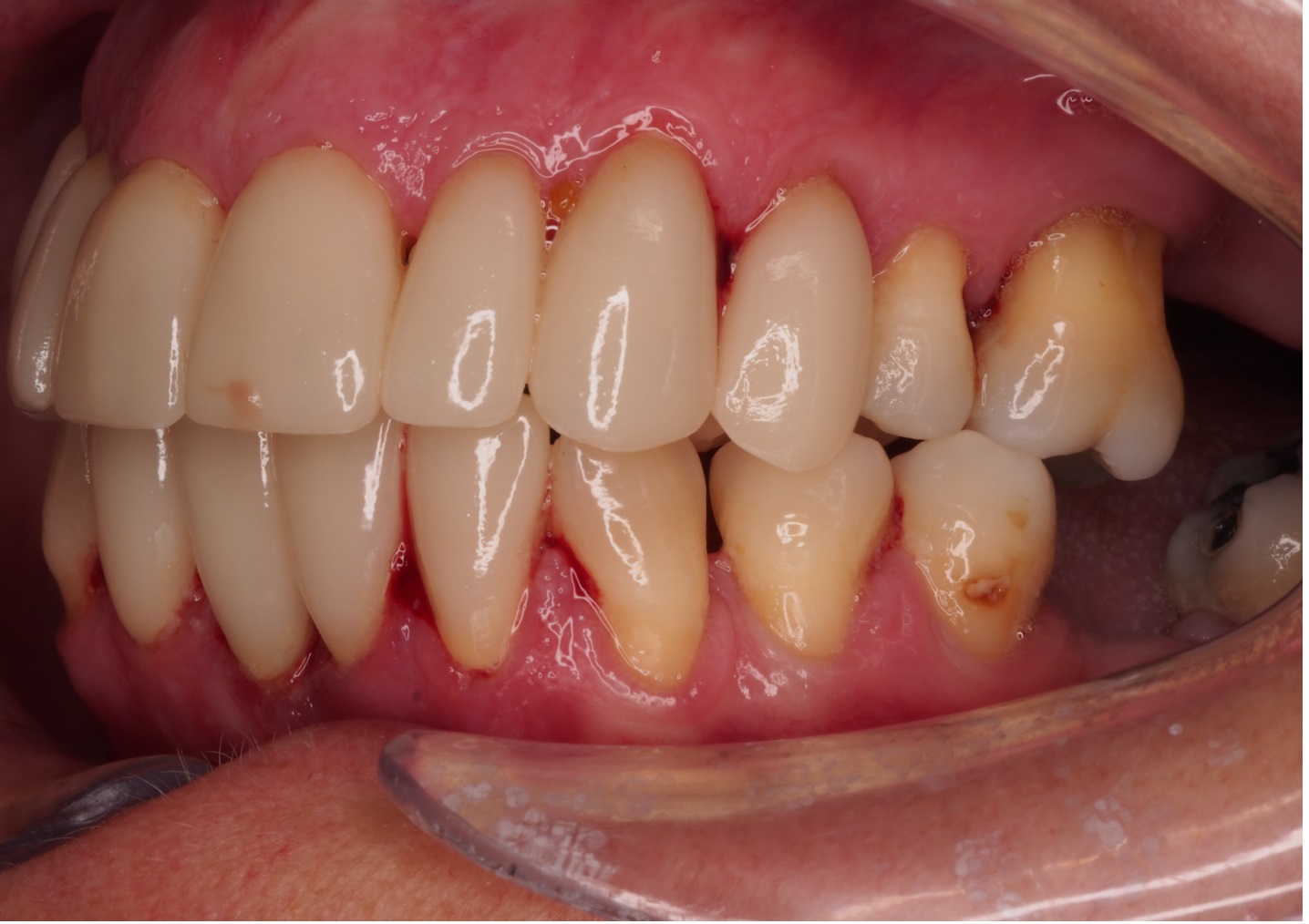 Before image