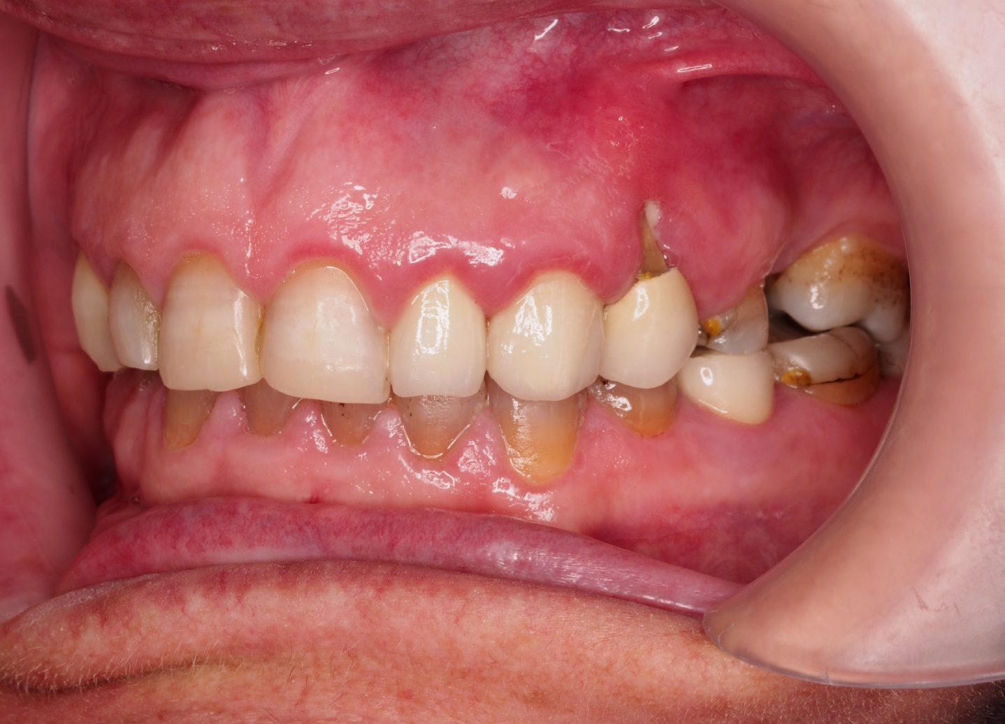 Before image