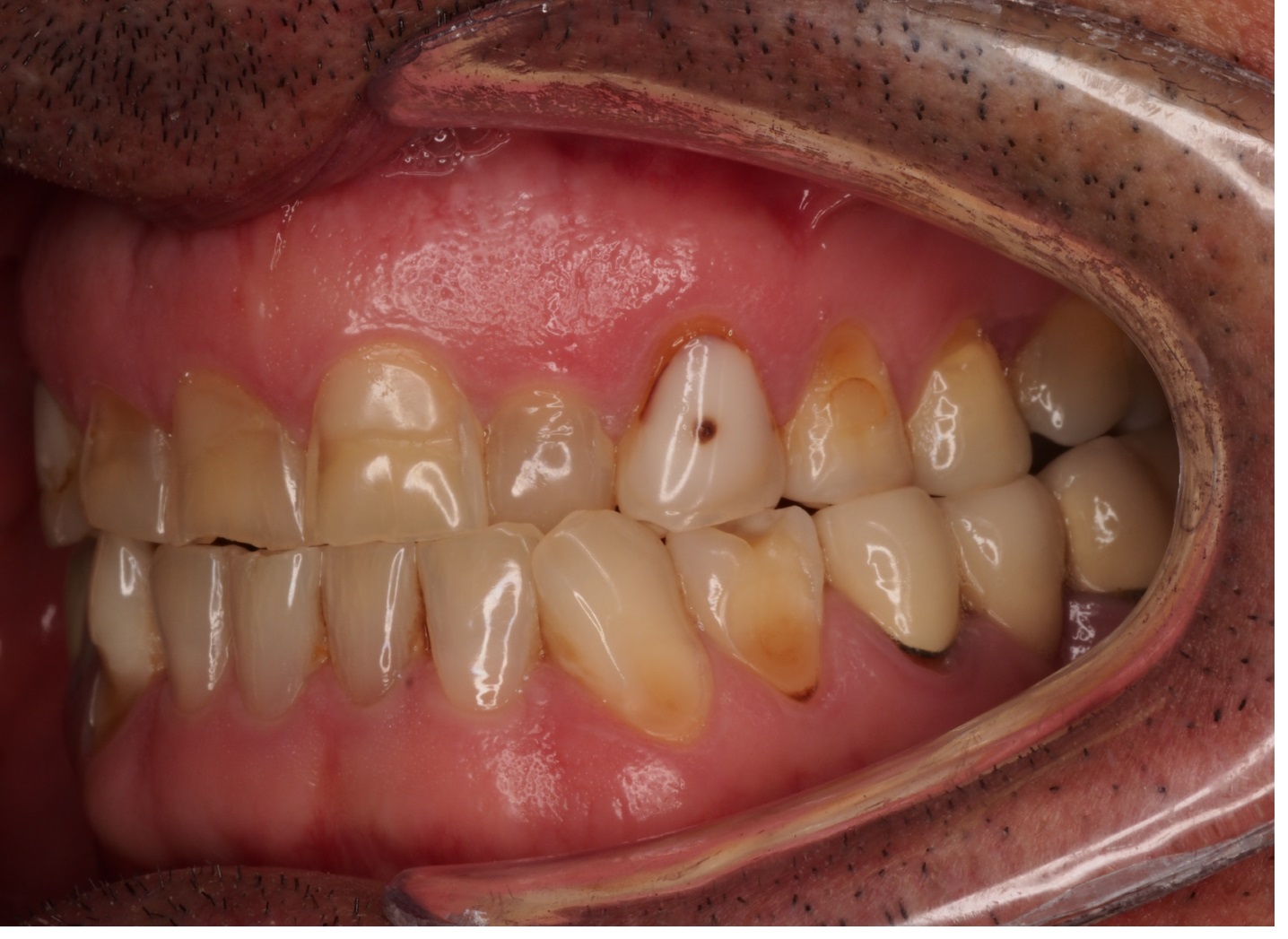 Before image
