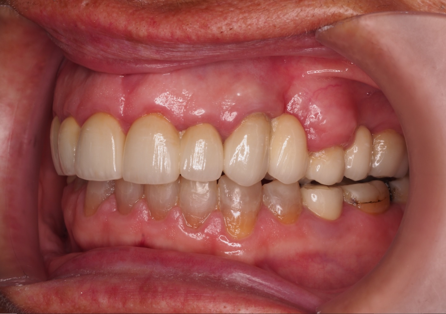 After image