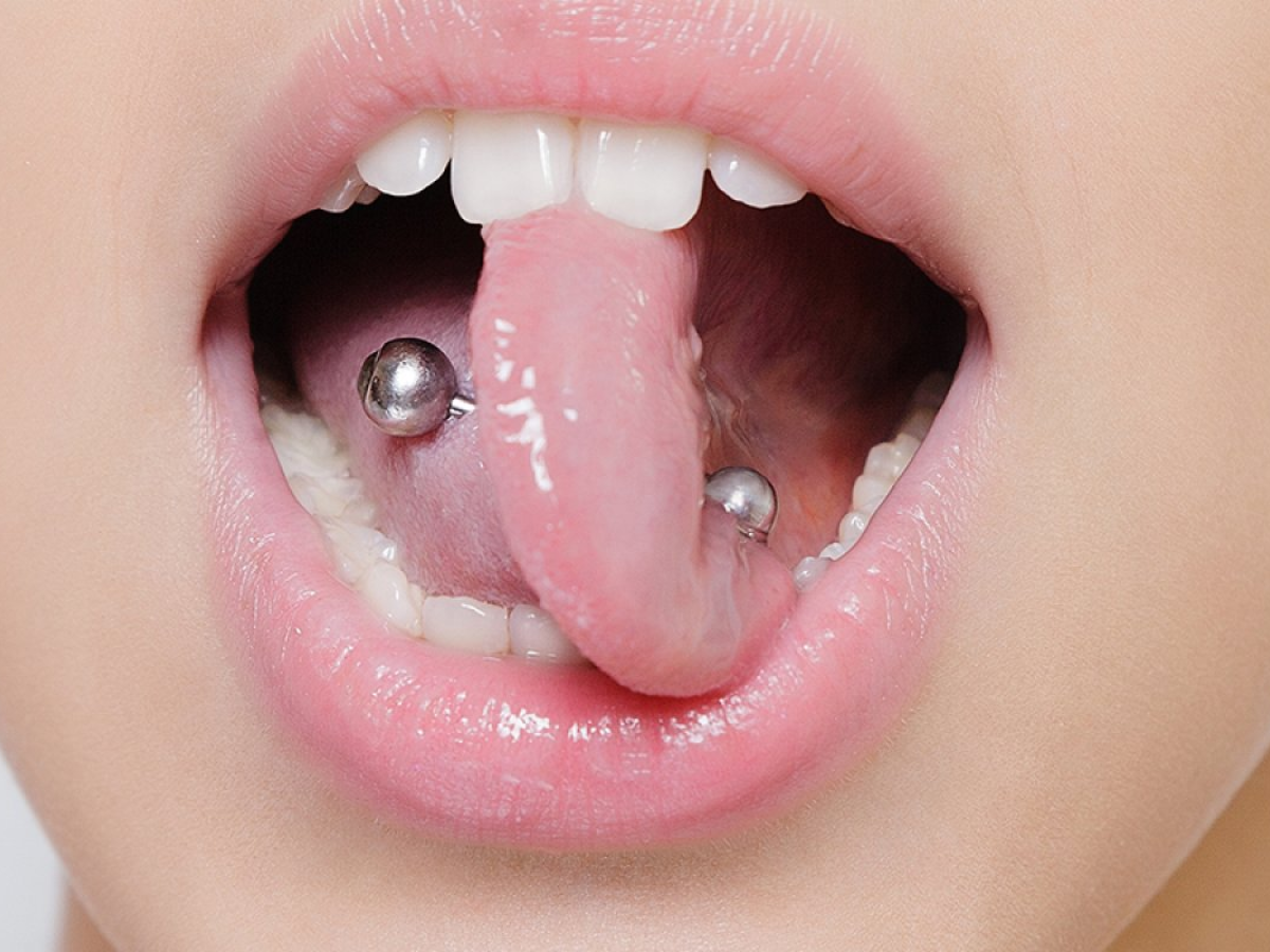 Los piercings orales ¿Una moda peligrosa?