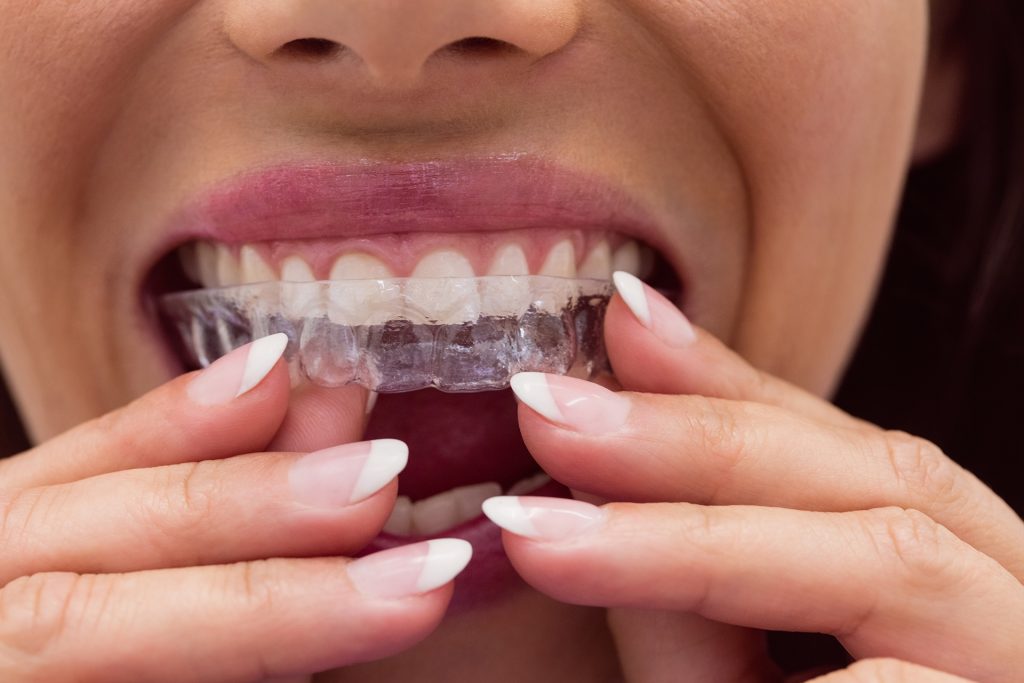 ¿Dejas tu salud oral a manos de internet?