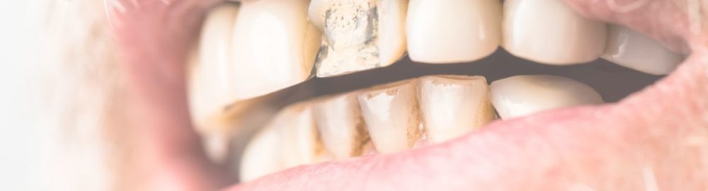 El futuro de la odontología: regenerar dientes será posible