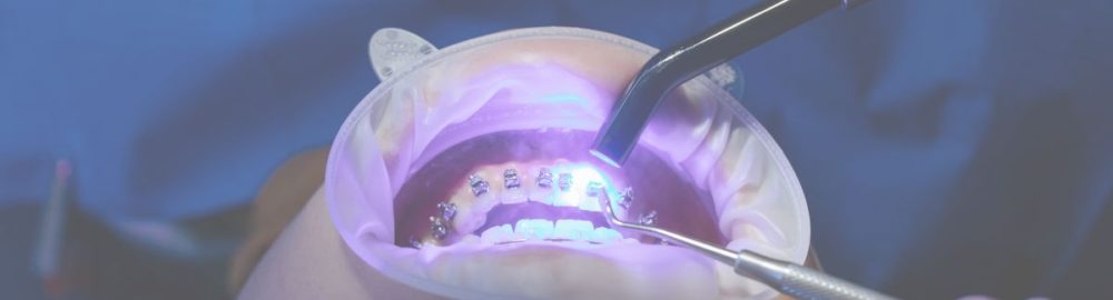 ¡Nunca es Tarde para Transformar tu Sonrisa! Ortodoncia y Blanqueamiento a Cualquier Edad