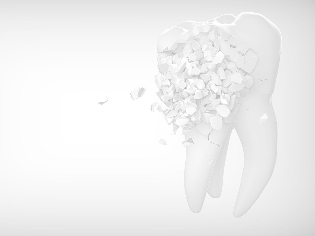 Los hábitos más comunes que están dañando tus dientes