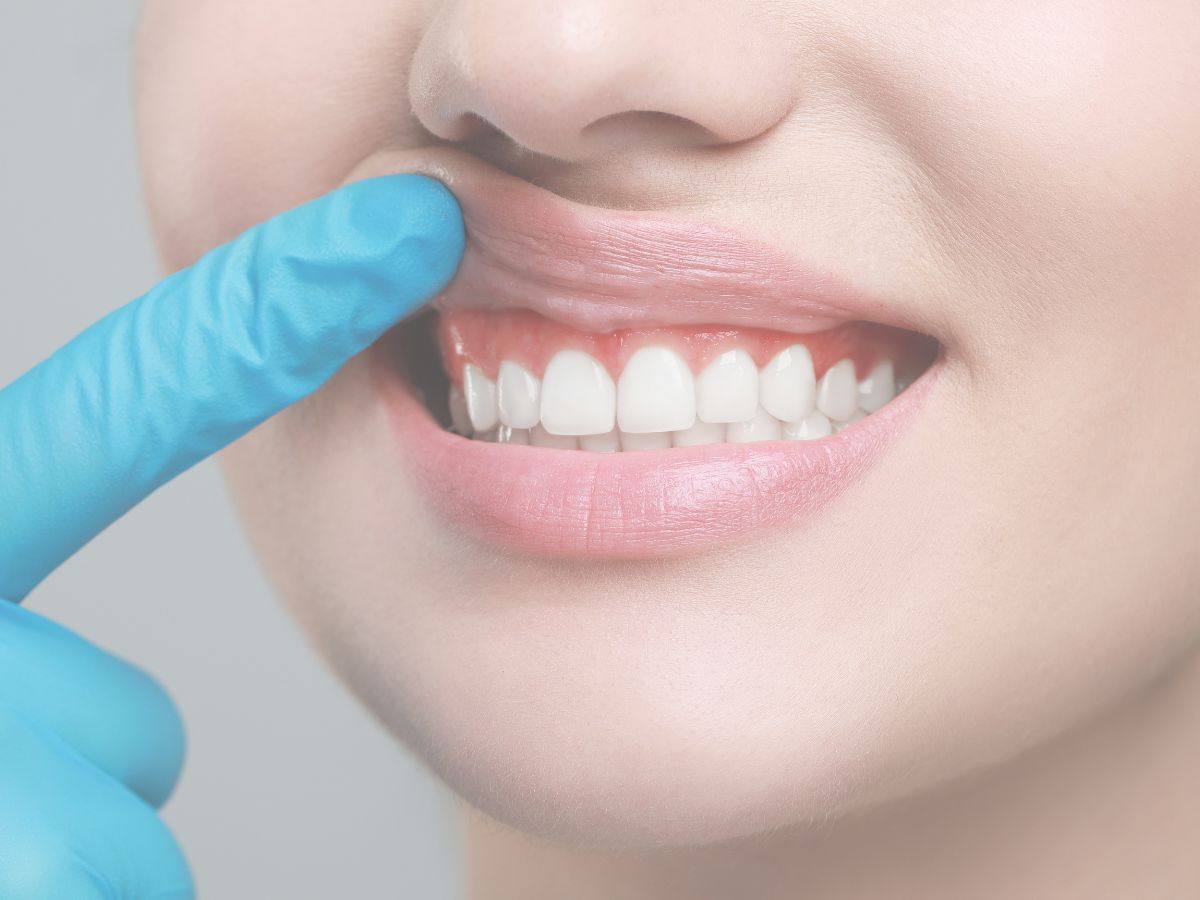 Retracción de encías: Los peligros de ignorar los primeros síntomas