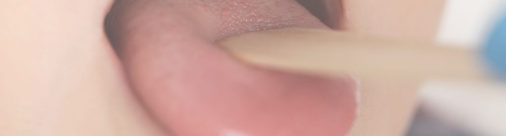 Tu lengua y su relación con tu salud oral: lo que necesitas saber